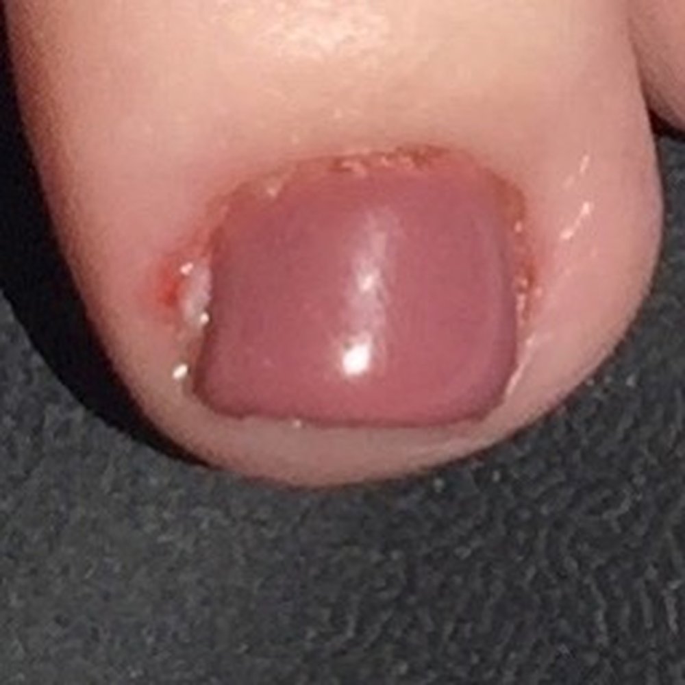 X-Nails - Just left. New owners and workers. Bad polish job along with a piece of skin she cut off my toe. All my toes have gel stuck to the cuticle - Nail Salons Near Me - Elk Grove, California X-Nails - Just left. New owners and workers. Bad polish job along with a piece of skin she cut off my toe. All my toes have gel stuck to the cuticle - Nail Salons Near Me - Elk Grove, California