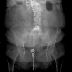 Interventional Spine and Pain Institute