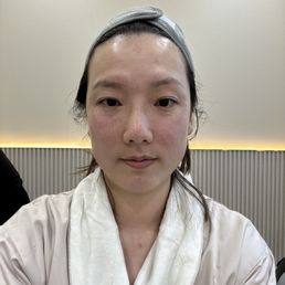 After After doing botox and picosure