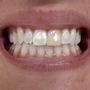 Photo of Newport Beach Dental - Dr. Lance Alder & Dr. Jacob Barton