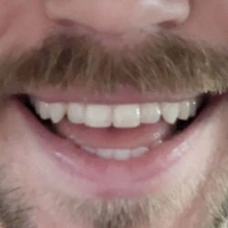 Confident Smiles - After
