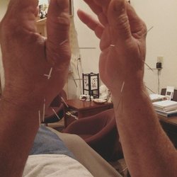 Pacific Healing Acupuncture - A little arthritis relief