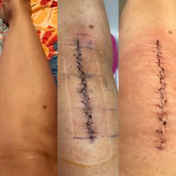 Russell M Nord, MD - Before , during & after