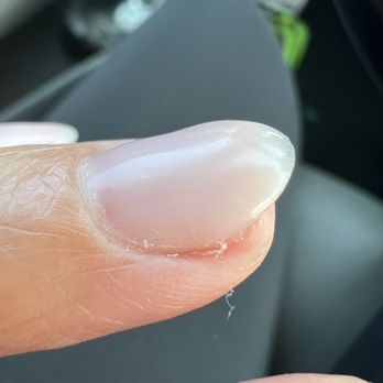 Posh Nails - Hangnail and uneven polish - Nail Salons Near Me - Manhattan Beach, California