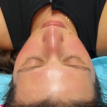 Sculpt-U Esthetics - Facial after - Skin Care Near Me - Las Vegas, Nevada Sculpt-U Esthetics - Facial after - Skin Care Near Me - Las Vegas, Nevada