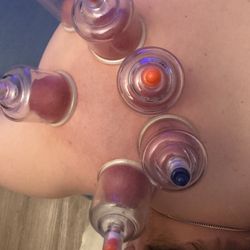Sasha Bodywork Massage - Sports massage cupping ,scraping, stretching