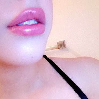 Advanced Aesthetics - Lips done by Bernie!! - Medical Spas Near Me - Las Vegas, Nevada Advanced Aesthetics - Lips done by Bernie!! - Medical Spas Near Me - Las Vegas, Nevada