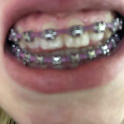 Rothenberg Orthodontics - This photo is upside down