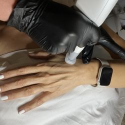 Selah Skin Studio - Jet Plasma Hand Treatment