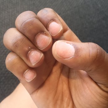 Campus Nails And Spa - Right hand not given a thought about. Just clipped and buffed and then tried to apply a nail tip. - Nail Salons Near Me - Columbia, South Carolina