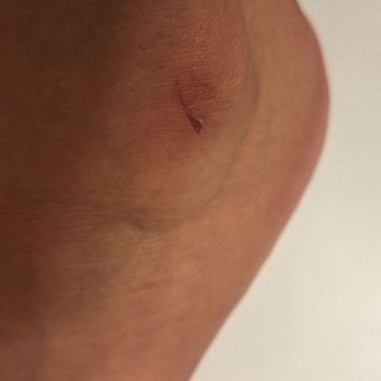 Burlington - Cut my foot trying to get thru a narrow aisle. - Women's Clothing Near Me - Colton, California