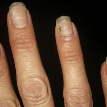 Plano Nail Bar - plano nail bar will give u a fungus run!!!!! - Nail Salons Near Me - Plano, Texas Plano Nail Bar - plano nail bar will give u a fungus run!!!!! - Nail Salons Near Me - Plano, Texas