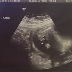 Karanzan Baby Imaging - Today 5/17 we were told by someone else it's a boy