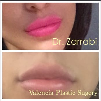 Valencia Plastic Surgery - Spot the difference... - Cosmetic Surgeons Near Me - Valencia, California