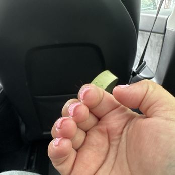 Avra Salon - Two sliced finger tips from aggressive filing - Nail Salons Near Me - Los Angeles, California