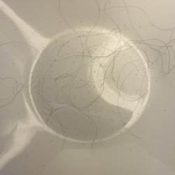Nitless Noggins - Marcy's results after my 7.5 hours of combing the day before. She still found more!!