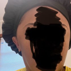 Face swollen
