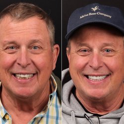 Dental Studio CDA - Full mouth reconstruction
