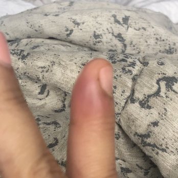 Jolie Nails - Infected nail - Nail Salons Near Me - Clawson, Michigan