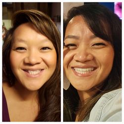 Dental Care of Pewaukee - Before and after