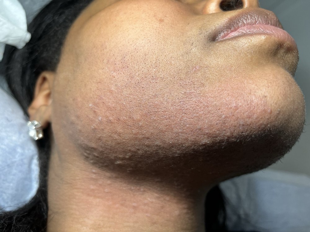 Electrolysis Studio At Queens Logo