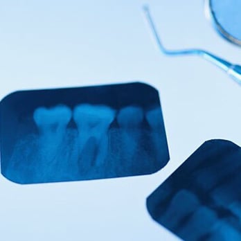 Woodside Dental Care - Dentistry is not expensive, Neglect is. - Orthodontists Near Me - Queens, New York Woodside Dental Care - Dentistry is not expensive, Neglect is. - Orthodontists Near Me - Queens, New York