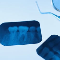 Woodside Dental Care - Dentistry is not expensive, Neglect is.