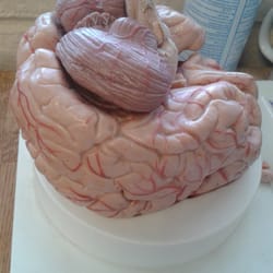 Benjamin P Ligot,MD - Brain!