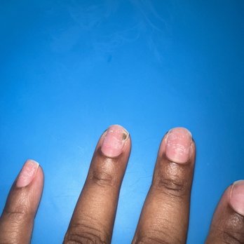 Paris Nails - The black mark is caused by poor application of the acrylics. - Nail Salons Near Me - Moreno Valley, California