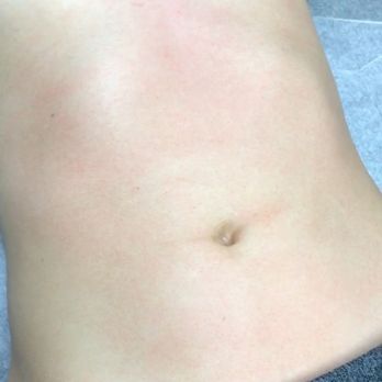 Speed Wax Studio - After Stomach Strip - Waxing Near Me - Altamonte Springs, Florida Speed Wax Studio - After Stomach Strip - Waxing Near Me - Altamonte Springs, Florida