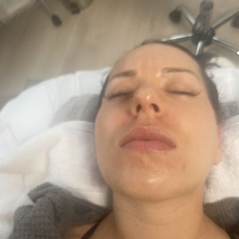 Renata Skin Studio - Dermaplanning - Medical Spas Near Me - Roswell, Georgia Renata Skin Studio - Dermaplanning - Medical Spas Near Me - Roswell, Georgia