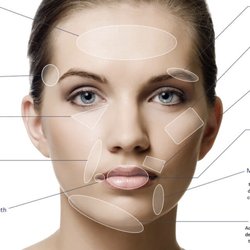 Luxe Dermatology & Aesthetic Center - Filler treatment areas