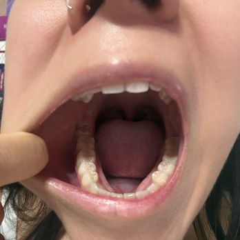 Aspen Dental - Burleson, TX - Oral Surgeons Near Me - Burleson, Texas Aspen Dental - Burleson, TX - Oral Surgeons Near Me - Burleson, Texas
