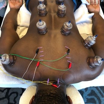 Balance Point Therapy - Acupuncture Near Me - Costa Mesa, California