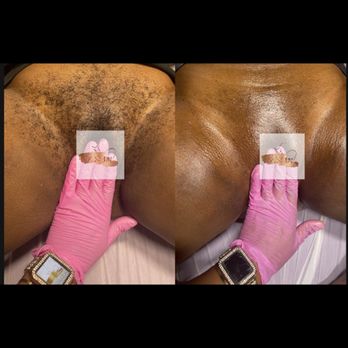 Skin By SM - Brazilian Wax - Skin Care Near Me - Somerset, New Jersey Skin By SM - Brazilian Wax - Skin Care Near Me - Somerset, New Jersey