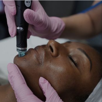 DREAM Aesthetics & Wellness Center - Hydrafacial - Medical Spas Near Me - Franklin, Wisconsin DREAM Aesthetics & Wellness Center - Hydrafacial - Medical Spas Near Me - Franklin, Wisconsin
