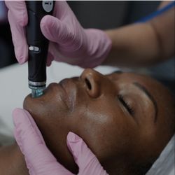 DREAM Aesthetics & Wellness Center - Hydrafacial