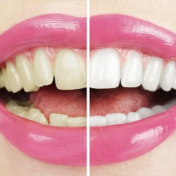 Beacon Hill Dental Centre - General Dentistry Near Me - Burlington, Ontario Beacon Hill Dental Centre - General Dentistry Near Me - Burlington, Ontario