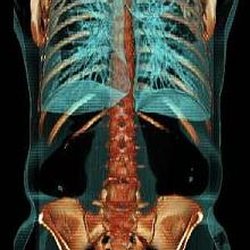Detect problems early - like cancer, aneurysm, heart disease - while treatment is easier and more successful.