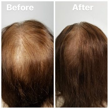 Scalp Excellence - Hair Loss Centers Near Me - Garden Grove, California Scalp Excellence - Hair Loss Centers Near Me - Garden Grove, California