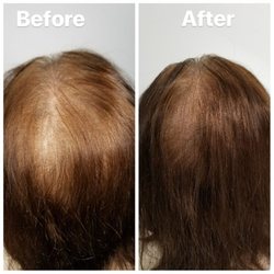 Scalp Excellence