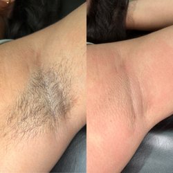 Smooth Bodies By Sam - Underarm Wax