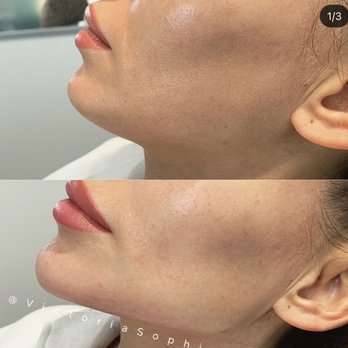VS Med Spas - Medical Spas Near Me - Beverly Hills, California