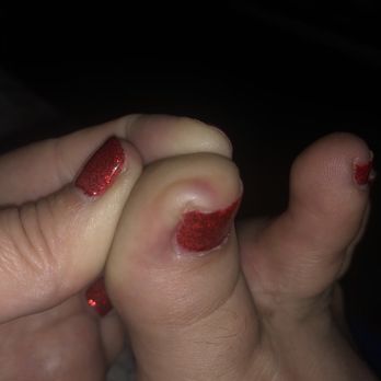 AK Nails & Spa - Infection from poor standards. I'm so grossed out and also concerned. This is NOT okay!!!! - Nail Salons Near Me - Phoenix, Arizona AK Nails & Spa - Infection from poor standards. I'm so grossed out and also concerned. This is NOT okay!!!! - Nail Salons Near Me - Phoenix, Arizona