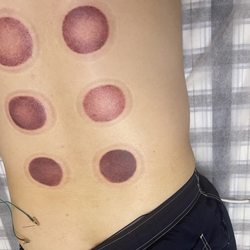 BL Acupuncture Clinic