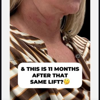 Marietta Plastic Surgery - Cosmetic Surgeons Near Me - Marietta, Georgia