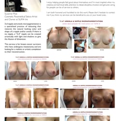 SUMA Ink - 3-d nipple/areola micropigmentation is for breast cancer survivors who have undergone mastectomy & wish to restore natural color