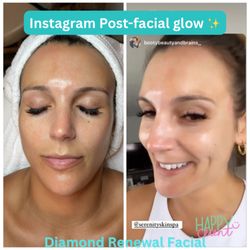 Serenity Skin Spa - My long-time client couldn't wait to share her results on IG! With consistent facials, her brown spots have faded and her skin keeps glowing
