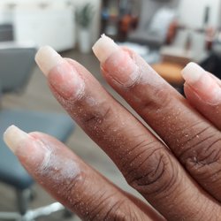 Luxury Nails - Look how healthy my nails have grown.....Bye Bye Graves disease...The dip is much more healthier....thanks again Katie....I love me some you