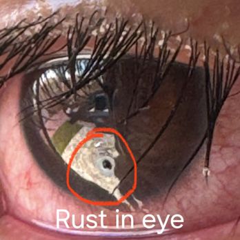 ER at blue diamond - This it what the ER missed!!!!!! - Emergency Rooms Near Me - Las Vegas, Nevada ER at blue diamond - This it what the ER missed!!!!!! - Emergency Rooms Near Me - Las Vegas, Nevada